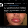 Chrissy Teigen : Victime d'un angio-oedème à la bouche le 16 août 2019.