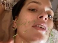 Ashley Graham enceinte : Acuponcture, saignements... Elle montre tout à ses fans