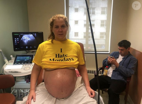 Amy Schumer et son mari Chris Fischer ont accueilli leur premier enfant le 5 mai 2019 : un garçon prénommé Gene.