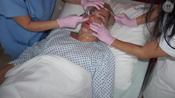 Rodrigo Alves, le "Ken Humain", lors d'une opération chirurgicale du visage au centre Medico Beauty & IVF de Prague, République tchèque, le 3 mai 2018.
