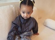 Kim Kardashian, sa fille Chicago chute : "Cicatrice sur le visage et sutures..."