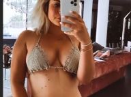 Carla Moreau liposucée : vives critiques après une photo de son corps
