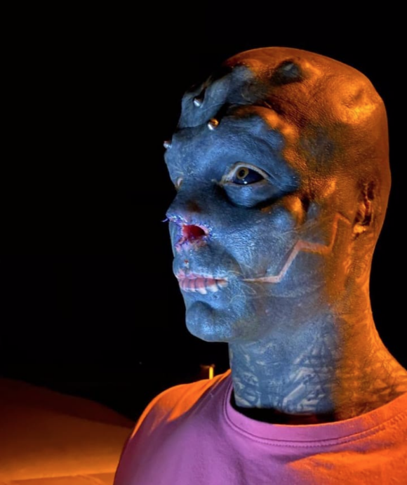 Le Black Alien, de son vrai nom Anthony Loffredo, montre son nouveau visage après s'être fait retirer le nez.