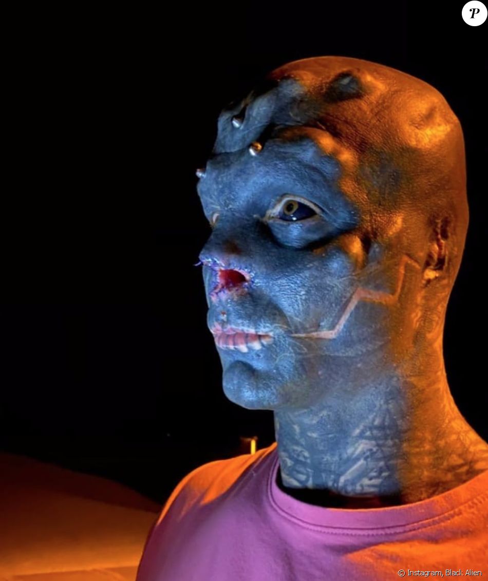 Le Black Alien, de son vrai nom Anthony Loffredo, montre son nouveau visage après s'être fait retirer le nez.