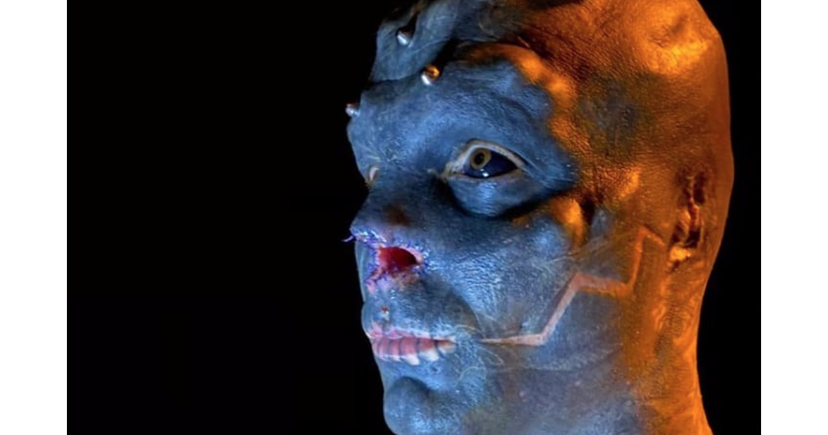 Instagram Star Artist Black Alien Has His Nose Removed