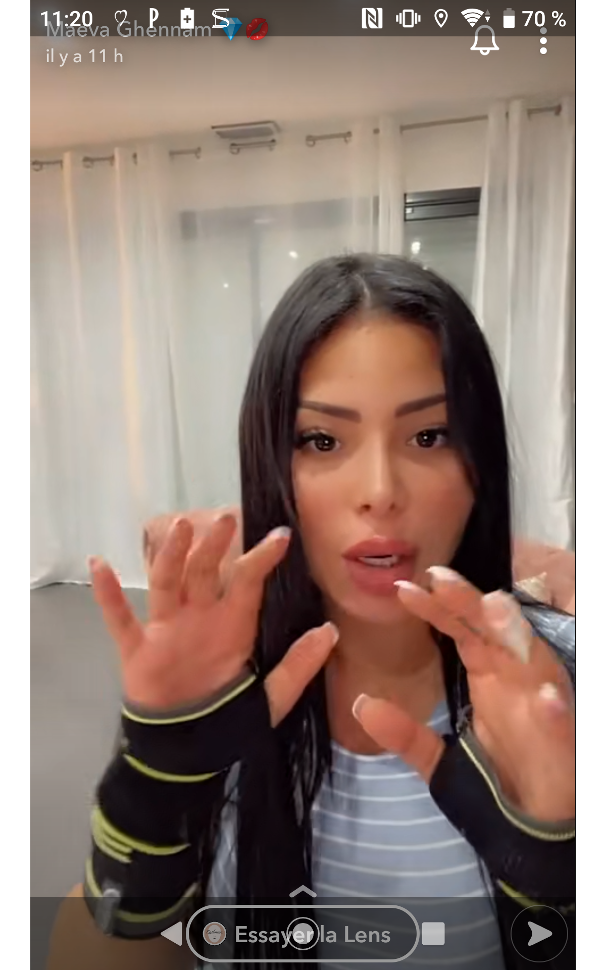 Photo : Maeva Ghennam avec deux attelles, sur Snapchat, le 22 mars 2021 -  Purepeople