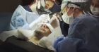 Ricardo : Nouvelle opération de chirurgie esthétique, il décide de partager son opération de greffe des cheveux sur Snaphat.