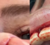 Manuela Lopez partage une photo choc de son opération des dents, le 30 juin 2021 sur Instagram.