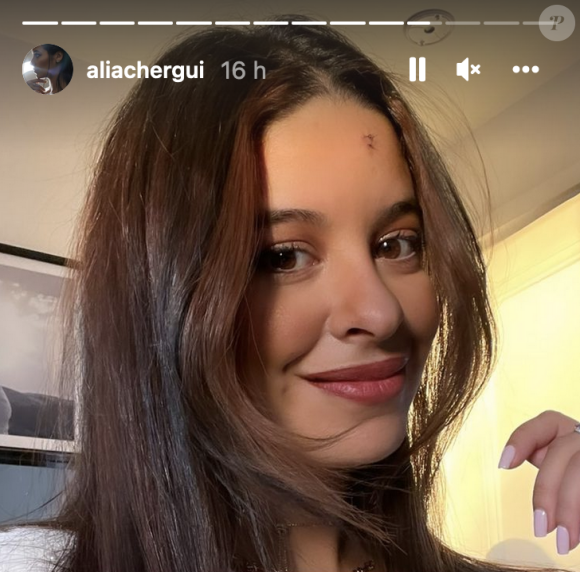 Alia Chergui (Secret Story) révèle avoir été victime d'un accident de trotinette - Instagram