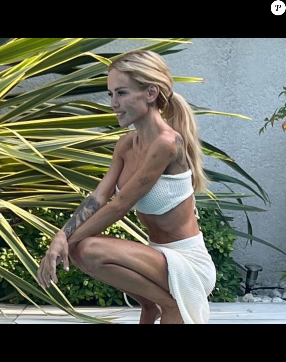 Aurélie Preston très amincie, photo choc sur Instagram