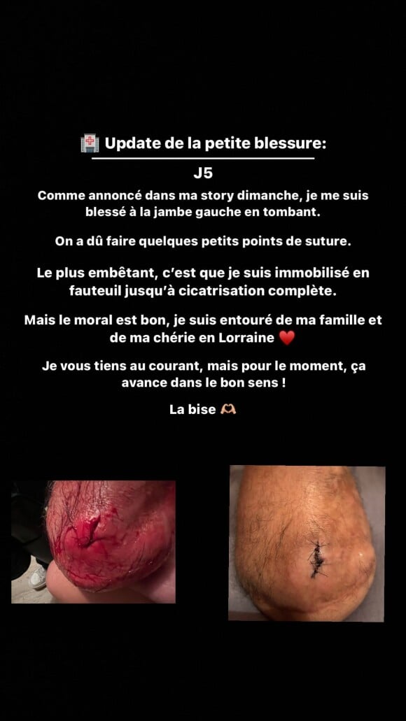 "Le plus embêtant , c'est que je suis immobilisé en fauteuil jusqu'à cicatrisation complète", ajoute-t-il
 
Théo Curin montre sa blessure au genou