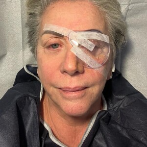 Le 2 juin, ses abonnés ont donc appris qu'elle avait subi une opération de la cataracte
Françoise Laborde opérée, elle donne de ses nouvelles sur Instagram, le 2 juin 2023