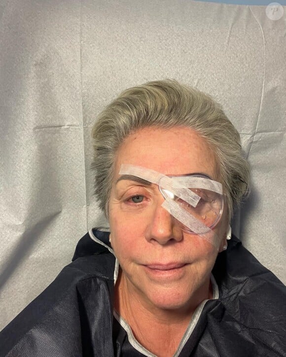 Le 2 juin, ses abonnés ont donc appris qu'elle avait subi une opération de la cataracte
Françoise Laborde opérée, elle donne de ses nouvelles sur Instagram, le 2 juin 2023