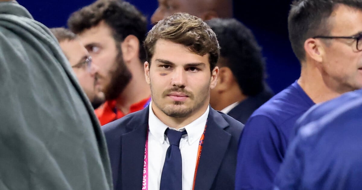 Il peut être rapidement infect" : Antoine Dupont désagréable avec ses  proches ? Son frère fait de surprenantes révélations : Le diaporama -  Purepeople