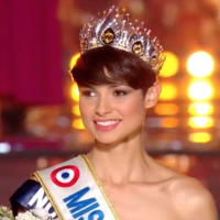 Miss France 2024 est Eve Gilles, Miss Nord-Pas-de-Calais à la particularité physique rare (et on l'avait prédit !)