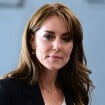 Protocole de chimiothérapie éprouvant pour Kate Middleton : des spécialistes révèlent les détails de son traitement