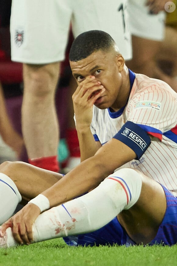 Lui qui pour rappel s'est fracturé le nez contre l'Autriche lundi soir. 
Kylian Mbappé a été victime d'une fracture du nez lors du du match du groupe D de l'Euro entre l'équipe de France face à l'Autriche (1-0) à Dusseldorf en Allemagne. Sorti avec le nez cassé après un choc avec Kevin Danso, Kylian Mbappé a passé des premiers examens qui laissent place à l'optimisme. L'intervention chirurgicale est écartée " dans l'immédiat ", selon la FFF. © Cyril Moreau/Bestimage