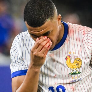 Et c'est aussi l'occasion de voir s'il porte un masque, comme prévu, ou pas.
Kylian Mbappé a été victime d'une fracture du nez lors du du match du groupe D de l'Euro 2024 entre l'équipe de France face à l'Autriche (1-0) à Dusseldorf en Allemagne le 17 jun 2024. Sorti avec le nez cassé après un choc avec Kevin Danso, Kylian Mbappé a passé des premiers examens qui laissent place à l'optimisme. L'intervention chirurgicale est écartée " dans l'immédiat ", selon la FFF.