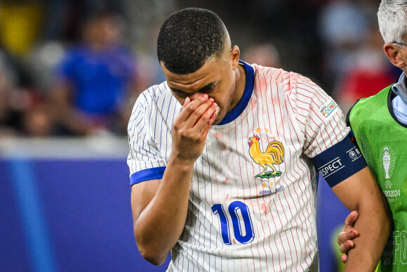 Et c'est aussi l'occasion de voir s'il porte un masque, comme prévu, ou pas.
Kylian Mbappé a été victime d'une fracture du nez lors du du match du groupe D de l'Euro 2024 entre l'équipe de France face à l'Autriche (1-0) à Dusseldorf en Allemagne le 17 jun 2024. Sorti avec le nez cassé après un choc avec Kevin Danso, Kylian Mbappé a passé des premiers examens qui laissent place à l'optimisme. L'intervention chirurgicale est écartée " dans l'immédiat ", selon la FFF.