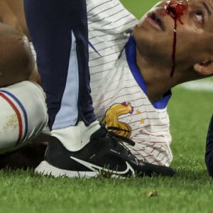 Car c'est bel et bien ce qui était prévu pour son retour.
Kylian Mbappé a été victime d'une fracture du nez lors du du match du groupe D de l'Euro 2024 entre l'équipe de France face à l'Autriche (1-0) à Dusseldorf en Allemagne le 17 jun 2024. Sorti avec le nez cassé après un choc avec Kevin Danso, Kylian Mbappé a passé des premiers examens qui laissent place à l'optimisme. L'intervention chirurgicale est écartée " dans l'immédiat ", selon la FFF. © Cyril Moreau/Bestimage