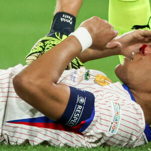 
Kylian Mbappé a été victime d'une fracture du nez lors du du match du groupe D de l'Euro 2024 entre l'équipe de France face à l'Autriche (1-0) à Dusseldorf en Allemagne le 17 jun 2024. Sorti avec le nez cassé après un choc avec Kevin Danso, Kylian Mbappé a passé des premiers examens qui laissent place à l'optimisme. L'intervention chirurgicale est écartée " dans l'immédiat ", selon la FFF.