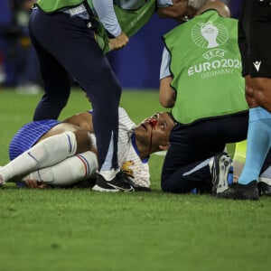 Sa participation pour le reste du tournoi est également incertaine.
Kylian Mbappé a été victime d'une fracture du nez lors du match du groupe D de l'Euro 2024 entre l'équipe de France et l'Autriche (1-0) à Dusseldorf en Allemagne le 17 jun 2024. Sorti avec le nez cassé après un choc avec Kevin Danso, Kylian Mbappé a passé des premiers examens qui laissent place à l'optimisme. L'intervention chirurgicale est écartée " dans l'immédiat ", selon la FFF. 