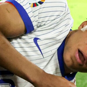 L'attaquant des Bleus s'est france turé le nez lors du premier match de l'Euro
 
Kylian Mbappé a été victime d'une fracture du nez lors du match du groupe D de l'Euro 2024 entre l'équipe de France et l'Autriche (1-0) à Dusseldorf en Allemagne le 17 jun 2024. Sorti avec le nez cassé après un choc avec Kevin Danso, Kylian Mbappé a passé des premiers examens qui laissent place à l'optimisme. L'intervention chirurgicale est écartée " dans l'immédiat ", selon la FFF.