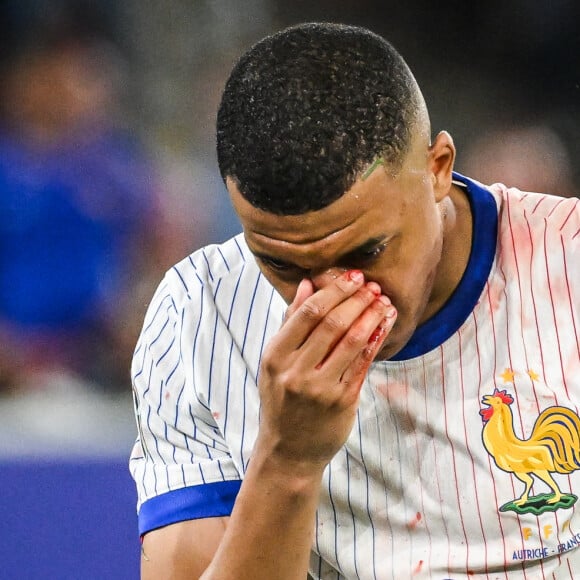 Kylian Mbappé est obligé de porter un masque de protection pour le reste de la compétition
 
Kylian Mbappé a été victime d'une fracture du nez lors du match du groupe D de l'Euro 2024 entre l'équipe de France et l'Autriche (1-0) à Dusseldorf en Allemagne le 17 jun 2024. Sorti avec le nez cassé après un choc avec Kevin Danso, Kylian Mbappé a passé des premiers examens qui laissent place à l'optimisme. L'intervention chirurgicale est écartée " dans l'immédiat ", selon la FFF.