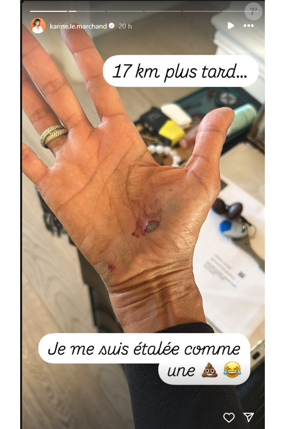 Karine Le Marchand s'est blesée et dévoile une photo