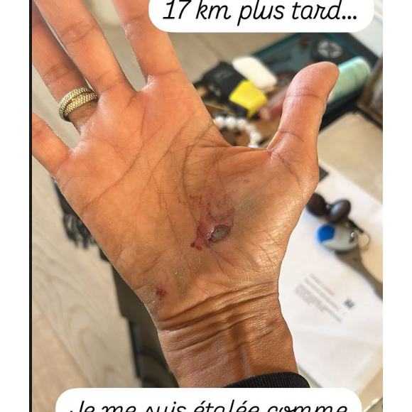 Karine Le Marchand s'est blesée et dévoile une photo