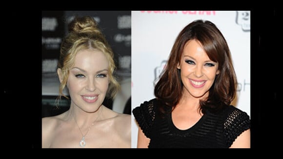 Kylie Minogue et la chirurgie esthétique : info ou in(bo)tox ?