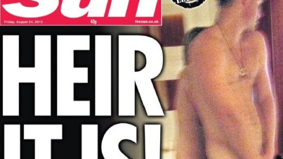 Prince Harry nu à la une : Les explications fermes de The Sun, un débat national