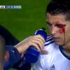 Cristiano Ronaldo blessé lors du match face à Levante le 11 novembre 2012 à Madrid