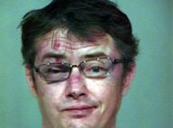 Jason London, passé à tabac : défiguré et le visage marqué après l'opération