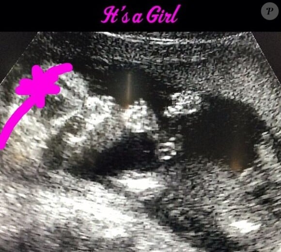 Kevin Jonas a posté un cliché de l'échographie de sa femme Danielle, qui attend une petite fille, sur Instagram, le 29 août 2013.