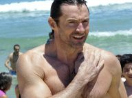Hugh Jackman : Musclé et remis de son cancer de la peau, il montre sa cicatrice