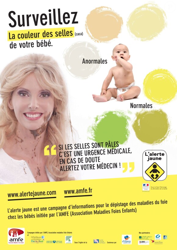 Frédérique Bel participe à la campagne de santé publique La Minute Blonde pour l'Alerte Jaune. Mars 2014