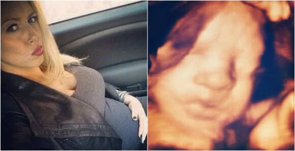Enceinte de 29 semaines, Stephanie (Secret Story 4) dévoile le visage de son futur bébé grâce à une échographie 3D. Une jolie photo postée le 1er décembre 2014 sur Instagram.