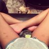 Chrissy Teigen a ajouté une photo de ses petits vergetures et ses bleus sur son compte Instagram, le 13 avril 2015