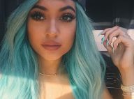 Kylie Jenner : Moquée pour ses lèvres, elle inspire un dangereux challenge