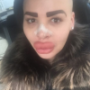 Jordan James s'est fait refaire le nez une seconde fois pour tenter de ressembler à Kim Kardahsian, et le menton pour imiter celui de Kylie Jenner. Photo publiée sur sa page Instagram au début du mois de mars 2016.