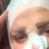 Jordan James s'est fait refaire le nez une seconde fois pour tenter de ressembler à Kim Kardahsian, et le menton pour imiter celui de Kylie Jenner. Photo publiée sur sa page Instagram au début du mois de mars 2016.