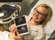 Alison Pill enceinte : La star de "The Newsroom" révèle le sexe du bébé