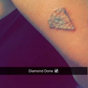 Caroline Receveur a fait retirer son tatouage représentant un diamant et a partagé la photo sur Snapchat, mercredi 14 septembre 2016