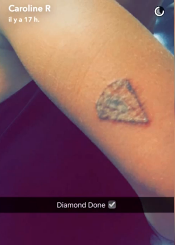 Caroline Receveur a fait retirer son tatouage représentant un diamant et a partagé la photo sur Snapchat, mercredi 14 septembre 2016
