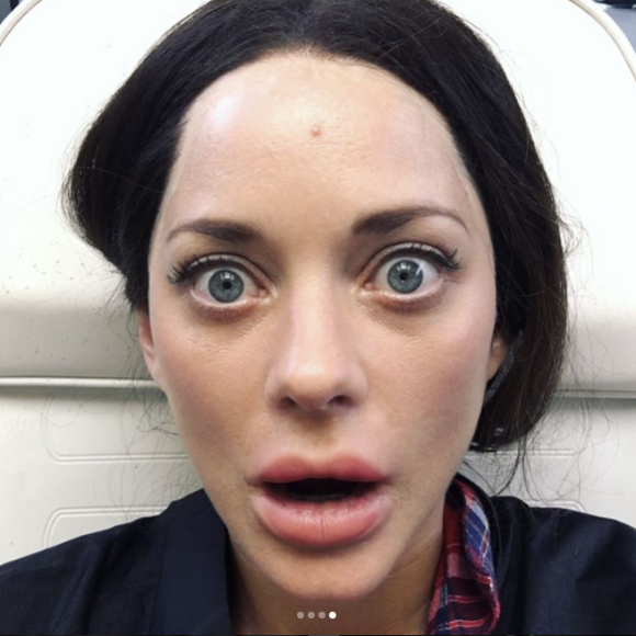 Marion Cotillard a fait le buzz sur Instagram le 7 mars 2017 avec une série de photos la montrant avec les lèvres gonflées, comme botoxées. Un nouveau coup de buzz autour de la comédie Rock'n roll de son compagnon Guillaume Canet.
