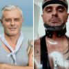Yves, "Koh-Lanta Cambodge" a été victime d'un accident