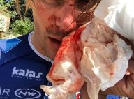 Yoann Offredo : Le cycliste agressé au cutter et à la batte de base-ball