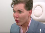 Rodrigo Alves, le Ken humain ultra-inquiet : "Votre nez va finir par tomber"
