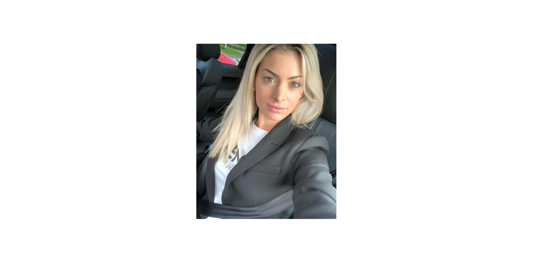 Mélanie Da Cruz Chirurgie Poitrine Mélanie Da Cruz : Ses lèvres transformées par la chirurgie esthétique ? -  Purepeople